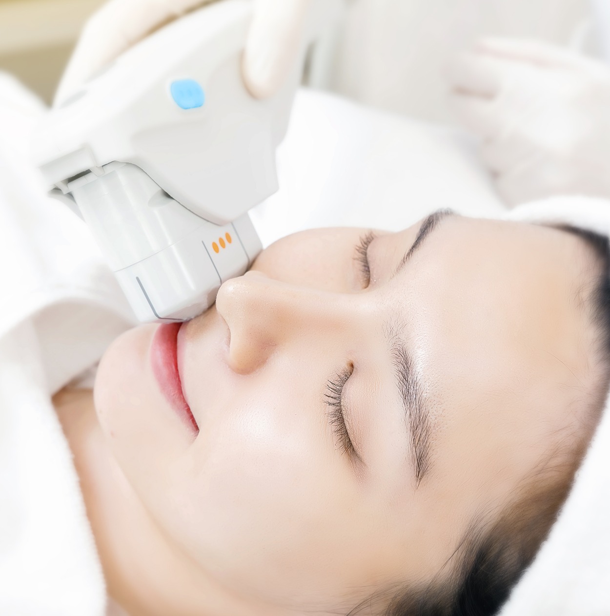 mylift- Mayfair facial rejuvenation services Mayfair Beauty and Wellness Centre Malaysia